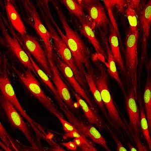 طور الباحثون طيفًا شاسعًا من التقنيات، للتعمق في دراسة بيولوجيا الخلايا المفردة، مثل خلايا الجلد المبينة في الصورة.
